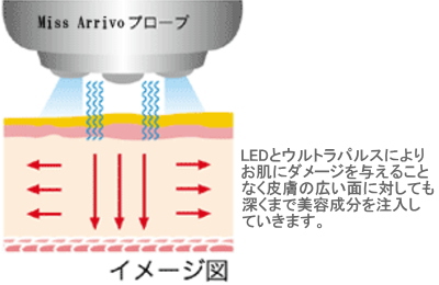 エレクトロポレーションの浸透図
